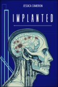 Implanted cover